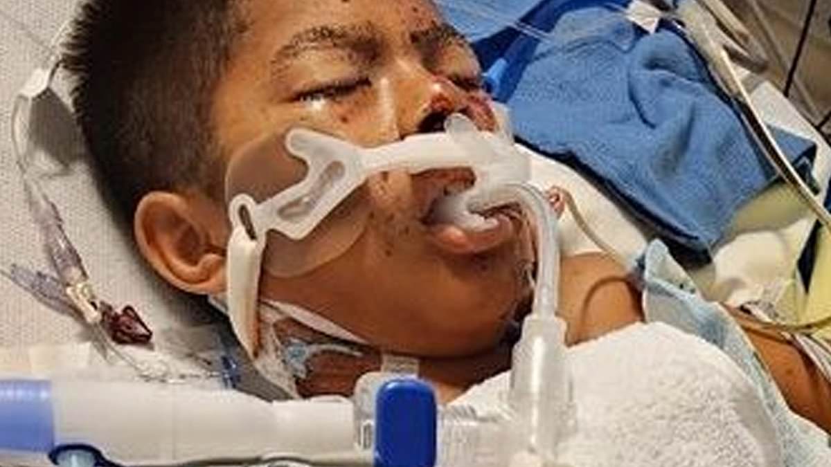 California Boy, 10, Suffers Severe Injuries and Loses Hand in Tragic Illegal Firework Explosion Incident in San Juan Capistrano